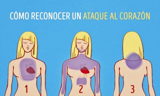 ataque-e1440445253969