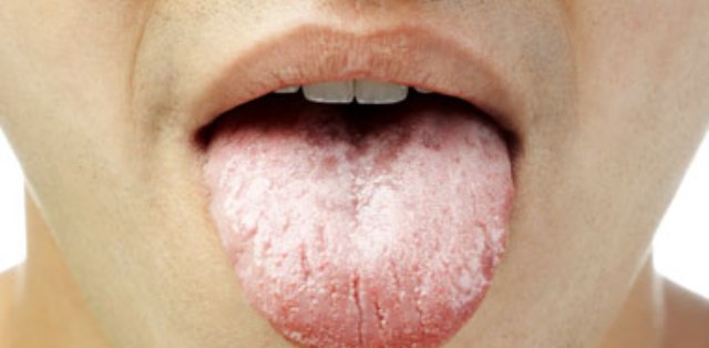 lengua_3