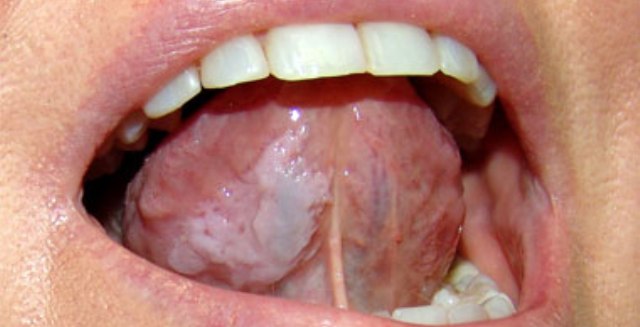 lengua_5
