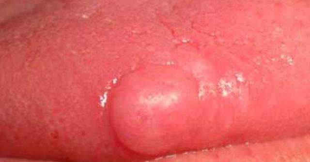 lengua_6