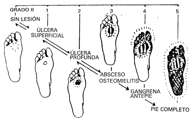 esquema