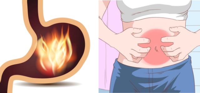 gastritis