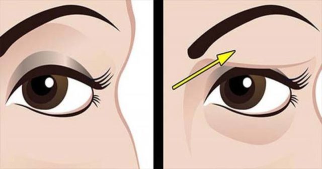 como-tratar-los-parpados-caidos-naturalmente-los-resultados-son-sorprendentes-210514534