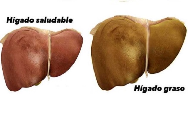 Maneras en que tu cuerpo te dice que tu HÍGADO ESTÁ DAÑADO - Medicina Sana