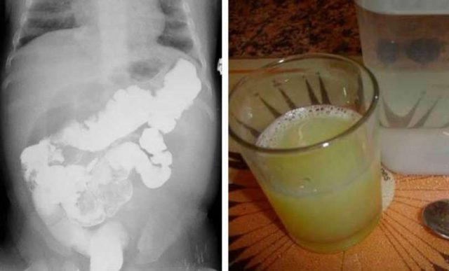 salud-detox-msd8bi69u636ha1lvc5avd168br5ucjtk16q2s9dpg