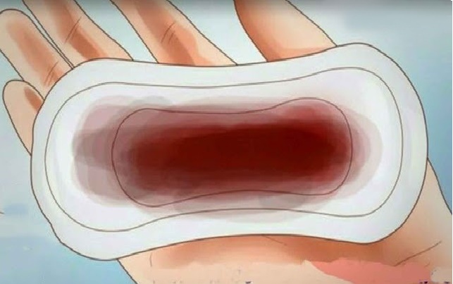 menstruacion oscura