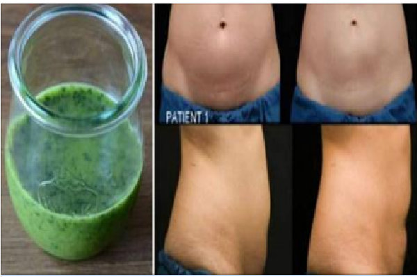 5-kilos-5-dias