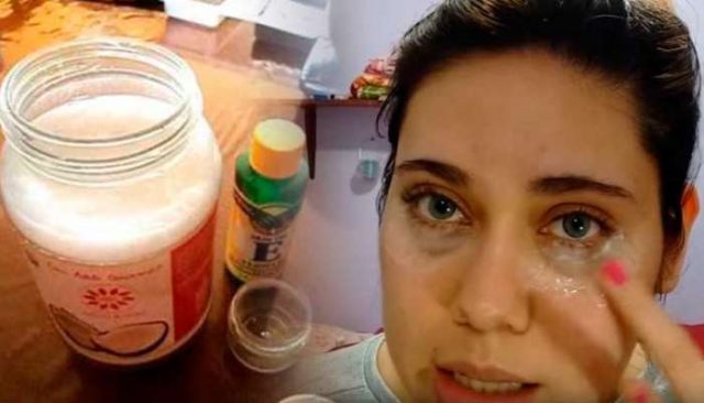 crema-para-ojeras